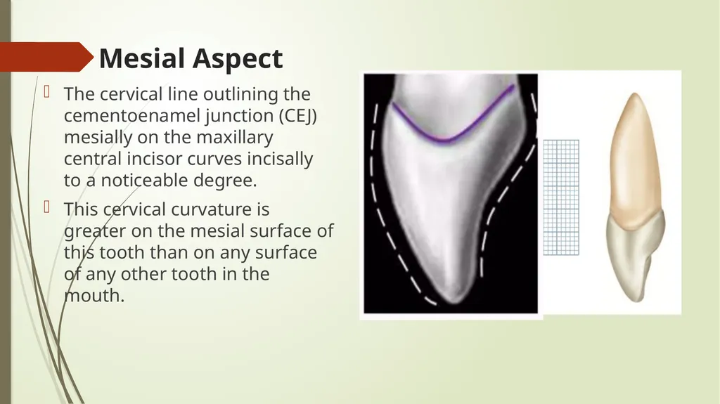 The Permanent Maxillary Incisors Dr. Pinar Khalis - slide 22 of 28