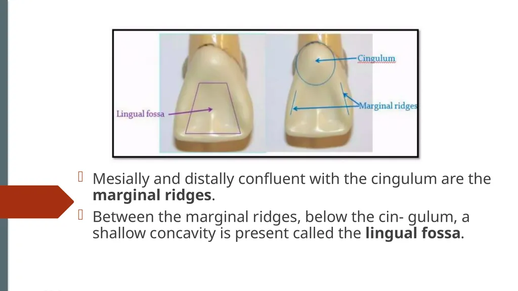 The Permanent Maxillary Incisors Dr. Pinar Khalis - slide 17 of 28