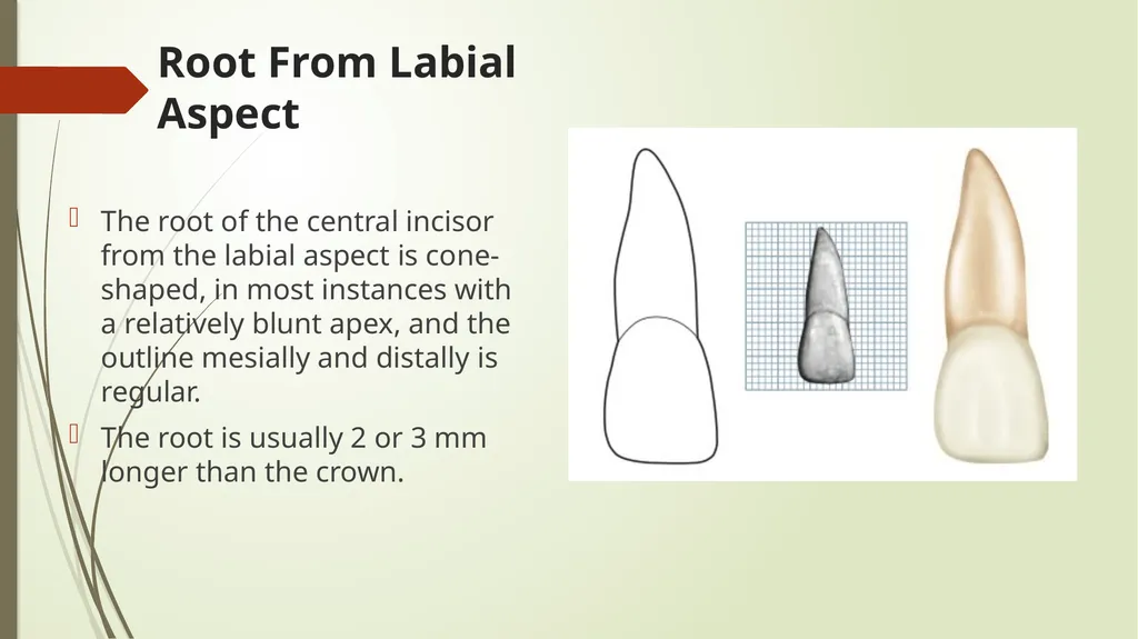 The Permanent Maxillary Incisors Dr. Pinar Khalis - slide 25 of 28
