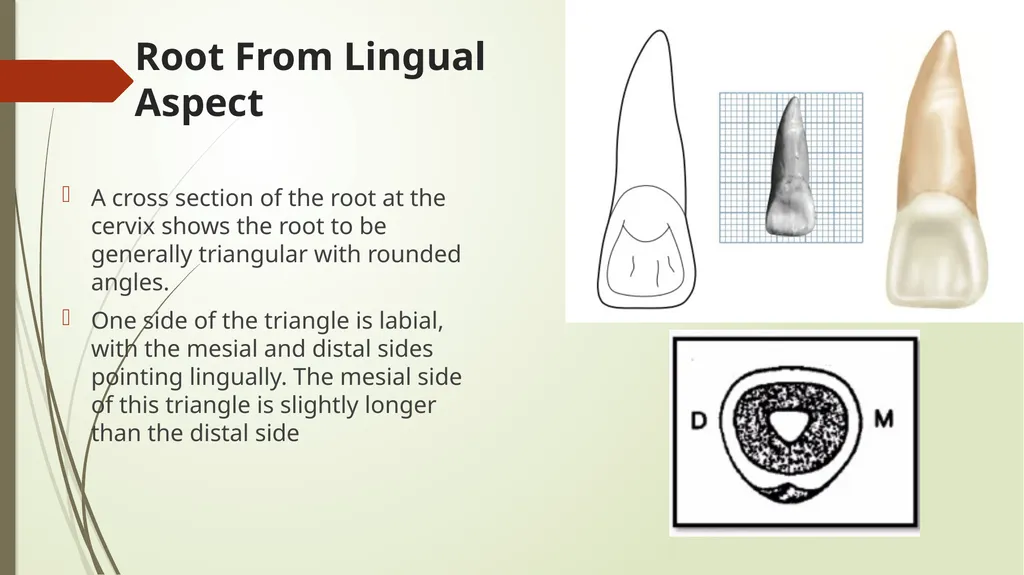 The Permanent Maxillary Incisors Dr. Pinar Khalis - slide 26 of 28