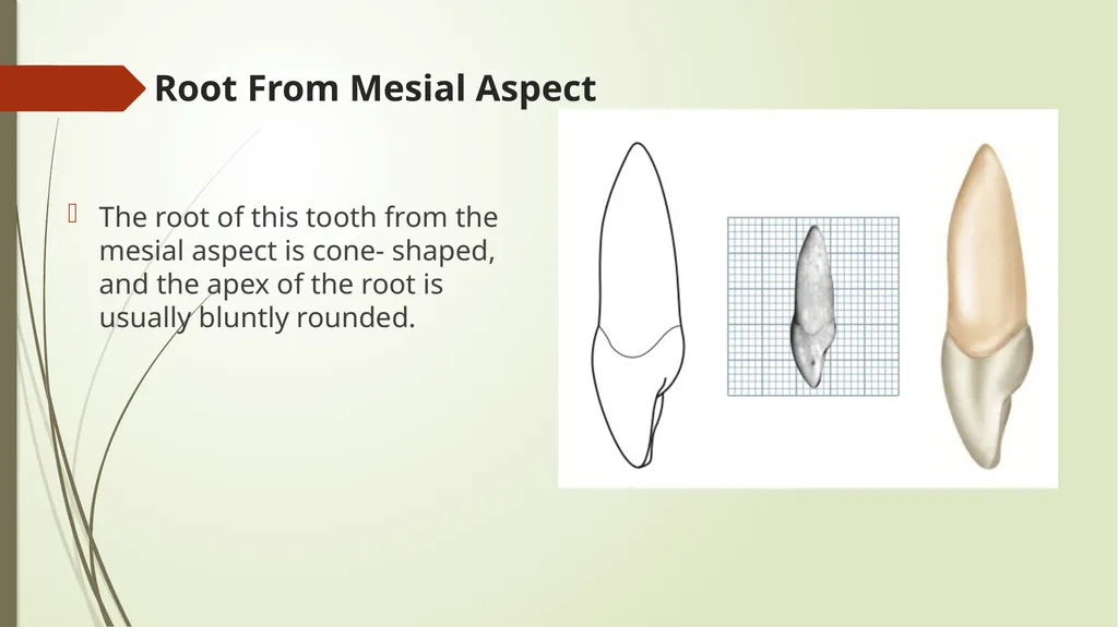 The Permanent Maxillary Incisors Dr. Pinar Khalis - slide 27 of 28