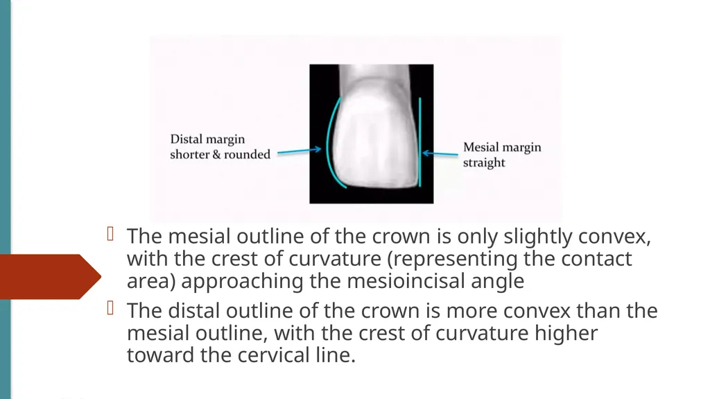 The Permanent Maxillary Incisors Dr. Pinar Khalis - slide 9 of 28