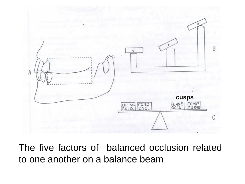 BALANCED OCCLUSION DEPARTMENT OF PROSTHODONTICS, - slide 28 of 41
