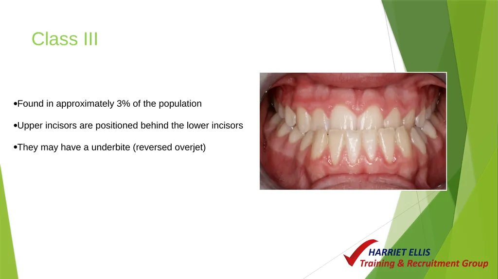 Orthodontics Module 9 Aim of todays session is to - slide 11 of 25