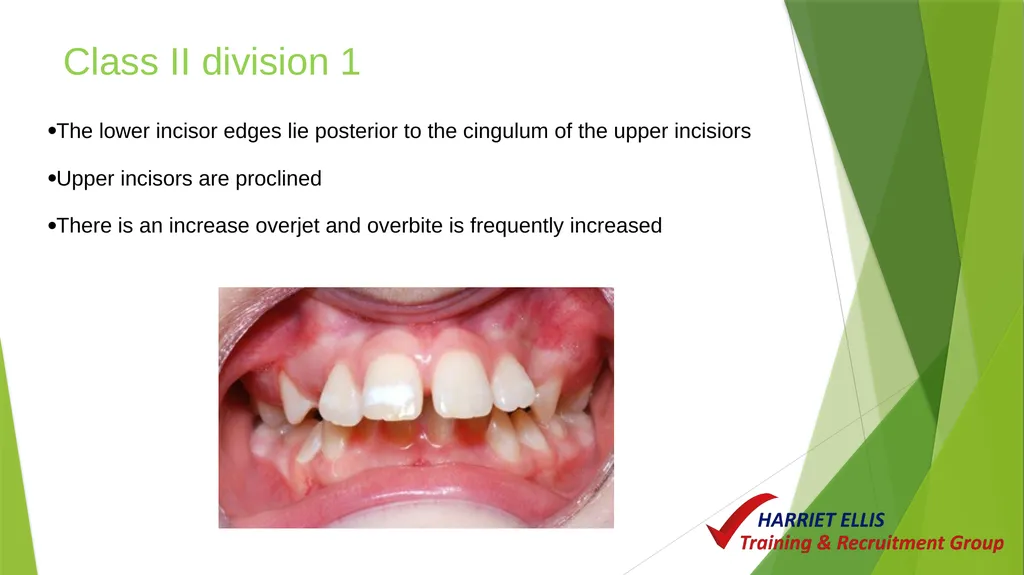 Orthodontics Module 9 Aim of todays session is to - slide 9 of 25