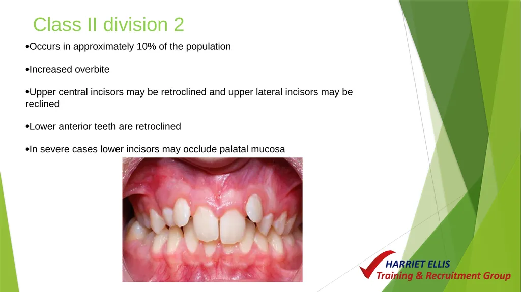 Orthodontics Module 9 Aim of todays session is to - slide 10 of 25