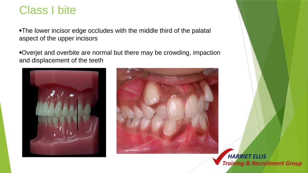 Orthodontics Module 9 Aim of todays session is to - slide 8 of 25