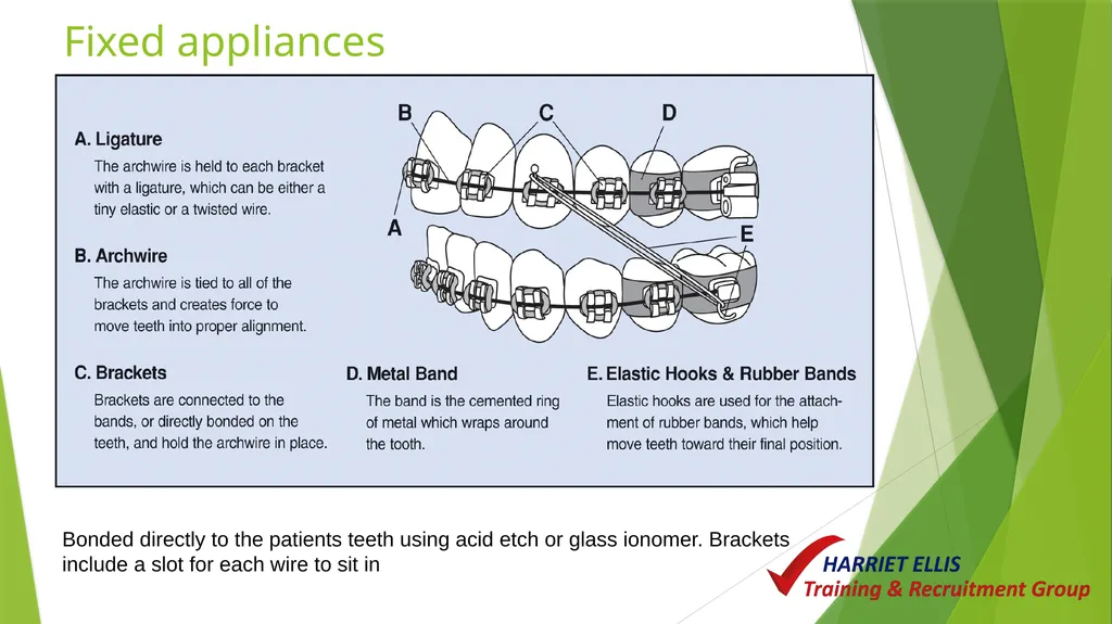 Orthodontics Module 9 Aim of todays session is to - slide 18 of 25