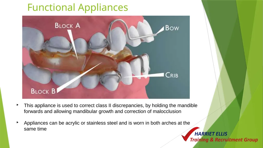 Orthodontics Module 9 Aim of todays session is to - slide 19 of 25