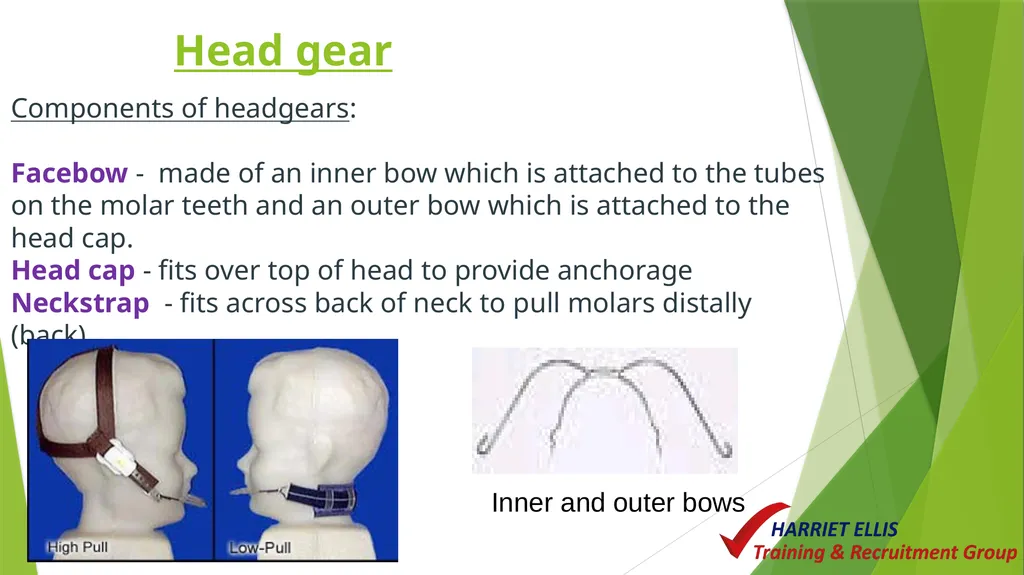 Orthodontics Module 9 Aim of todays session is to - slide 21 of 25