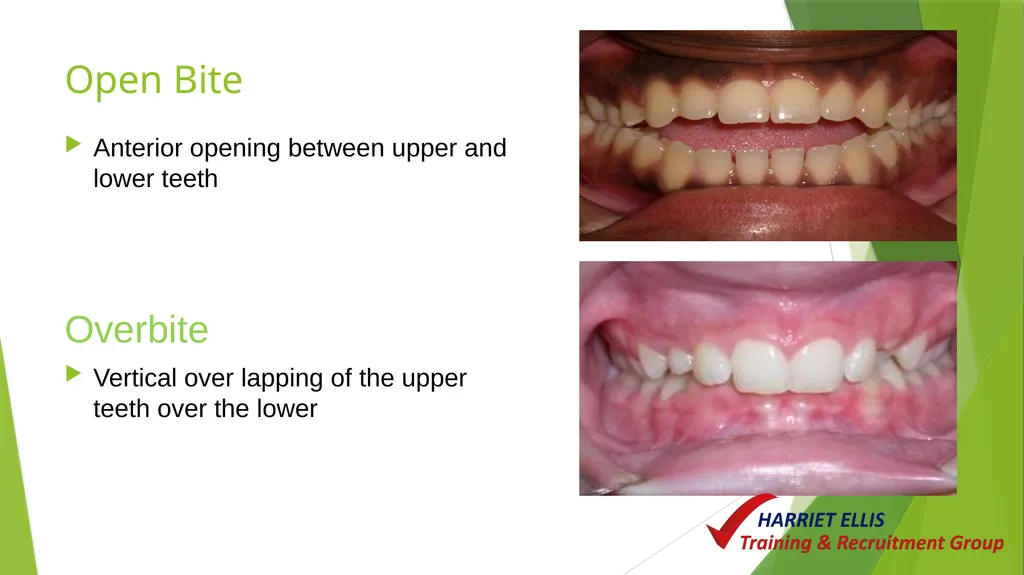 Orthodontics Module 9 Aim of todays session is to - slide 12 of 25