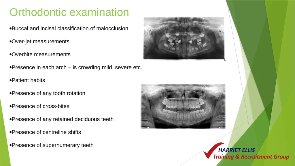 Orthodontics Module 9 Aim of todays session is to - slide 4 of 25