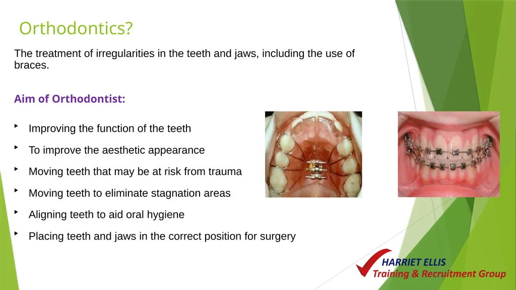 Orthodontics Module 9 Aim of todays session is to - slide 3 of 25