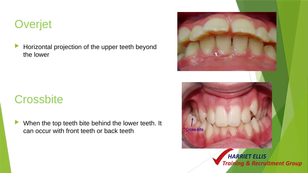 Orthodontics Module 9 Aim of todays session is to - slide 13 of 25