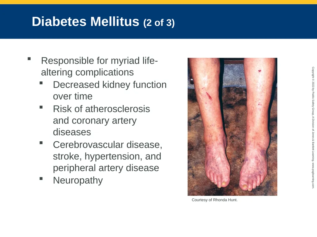 Endocrine and Hematologic Emergencies CHAPTER 21: - slide 15 of 67