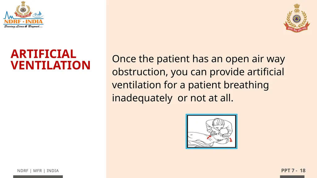 - 1 LESSON 7 Basic Life Support (BLS) and - slide 18 of 41