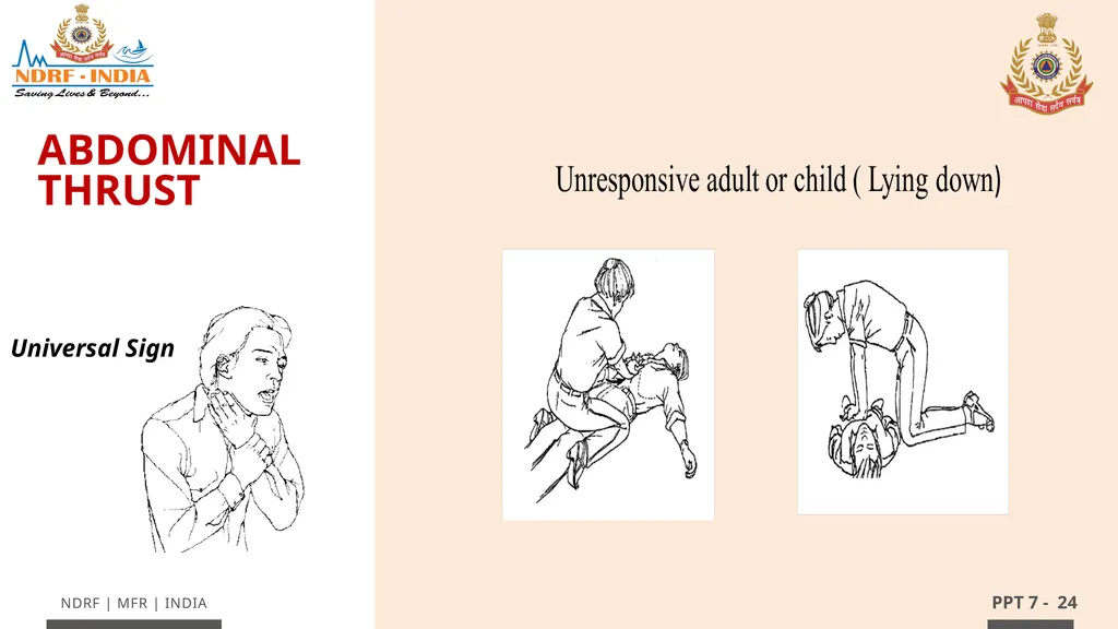 - 1 LESSON 7 Basic Life Support (BLS) and - slide 24 of 41