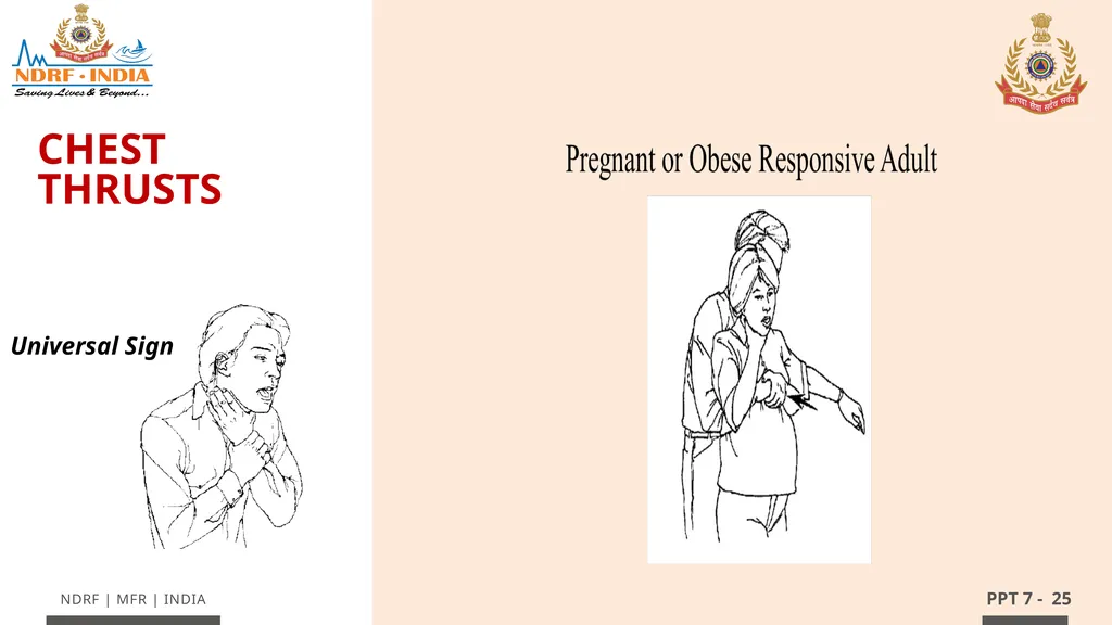 - 1 LESSON 7 Basic Life Support (BLS) and - slide 25 of 41