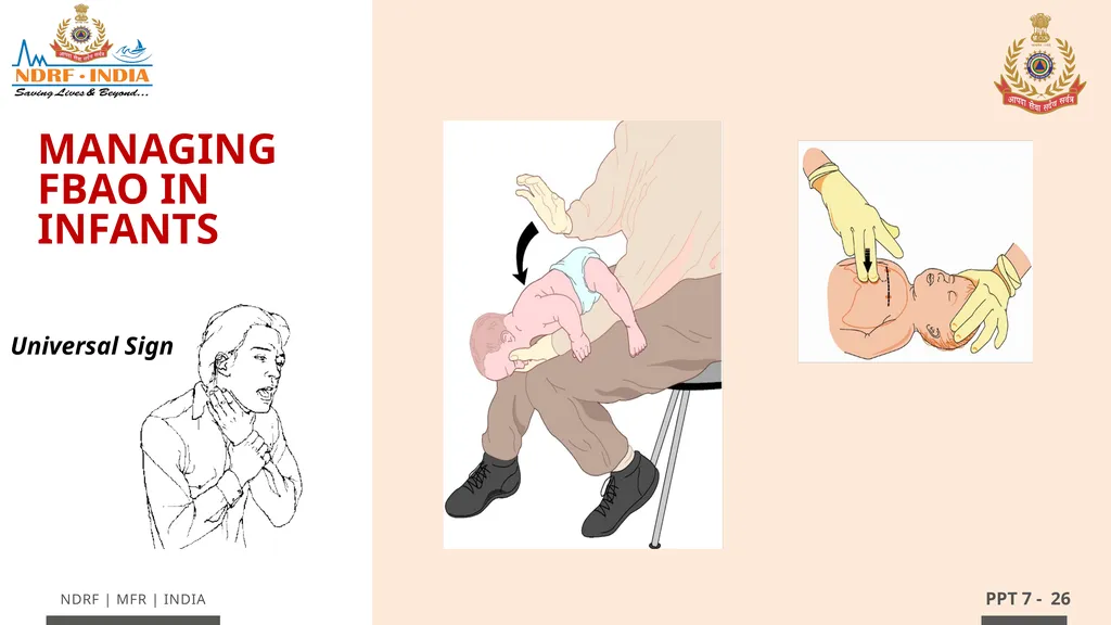 - 1 LESSON 7 Basic Life Support (BLS) and - slide 26 of 41
