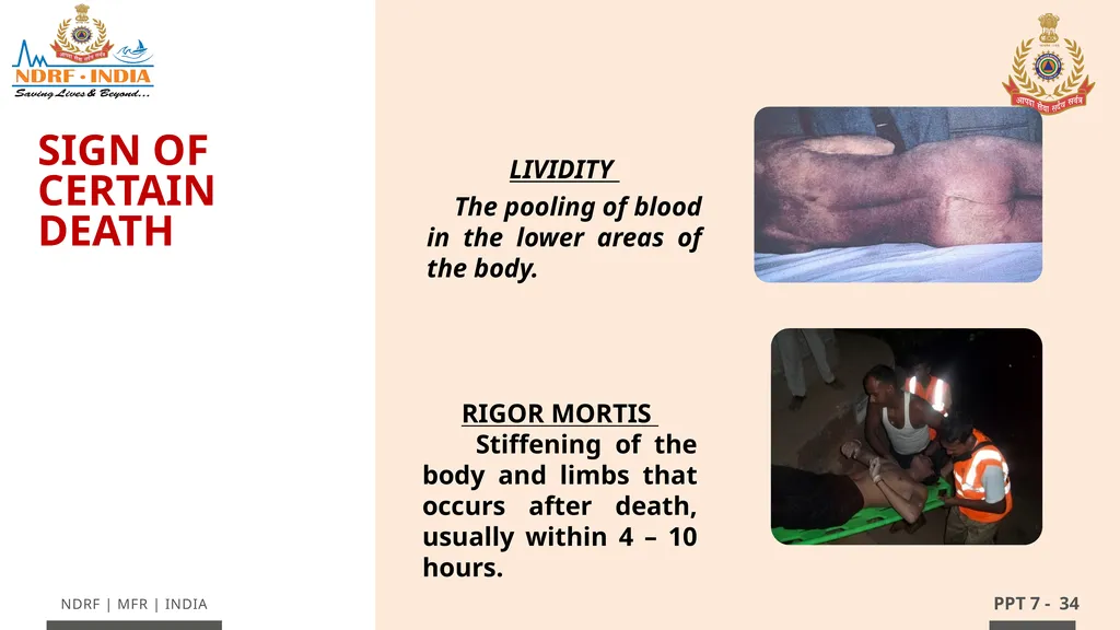 - 1 LESSON 7 Basic Life Support (BLS) and - slide 34 of 41