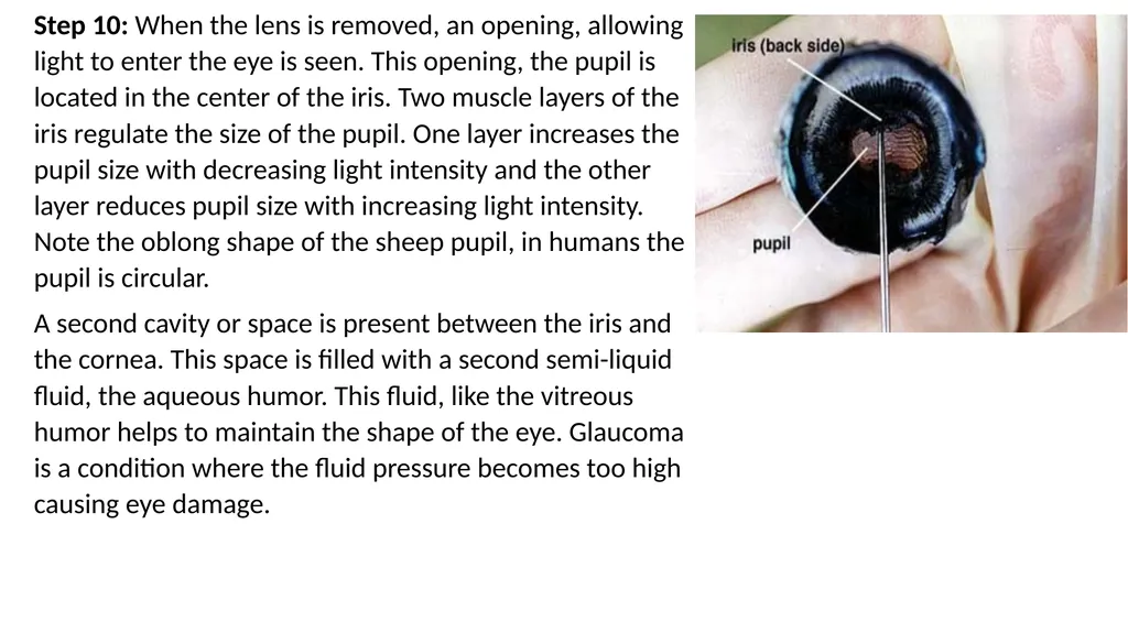 Eye Dissection Instructions Coach Blakley Step 1: - slide 10 of 11