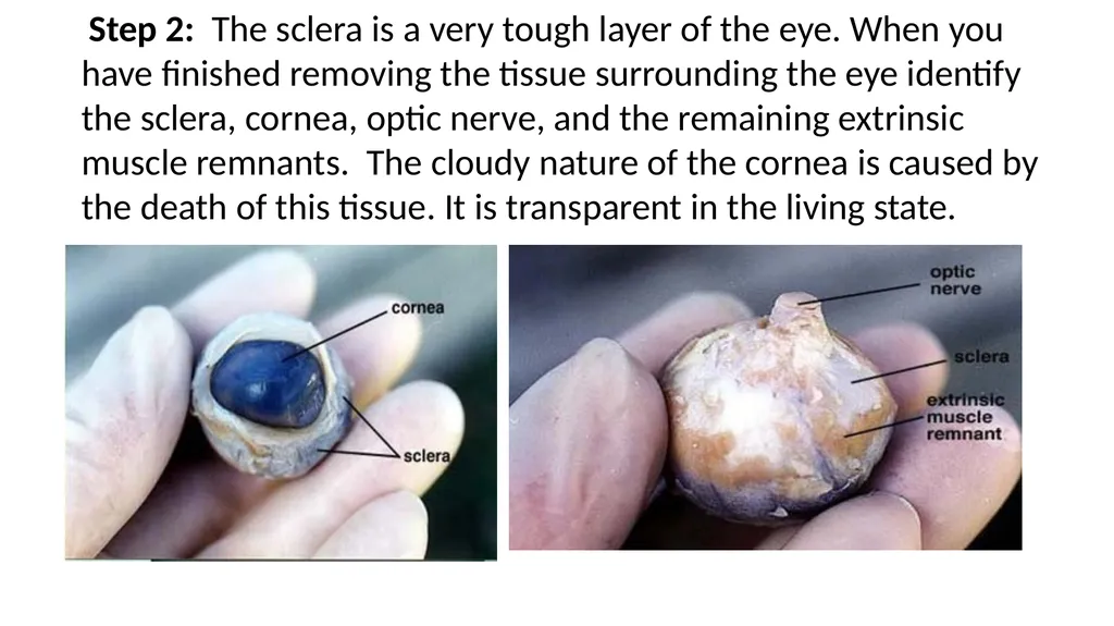Eye Dissection Instructions Coach Blakley Step 1: - slide 3 of 11