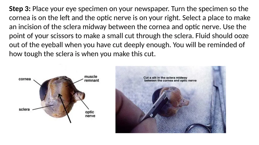 Eye Dissection Instructions Coach Blakley Step 1: - slide 4 of 11