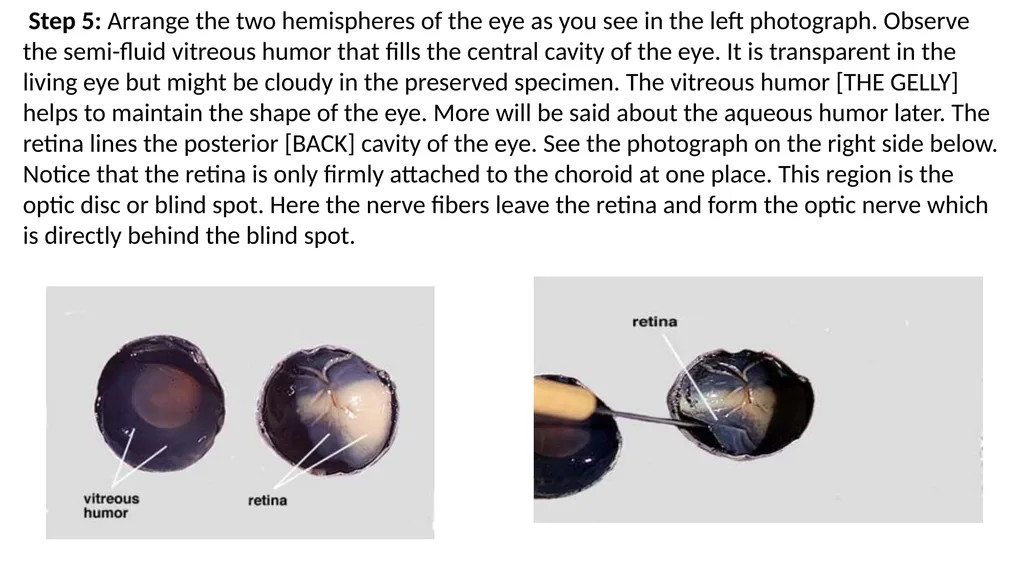 Eye Dissection Instructions Coach Blakley Step 1: - slide 6 of 11