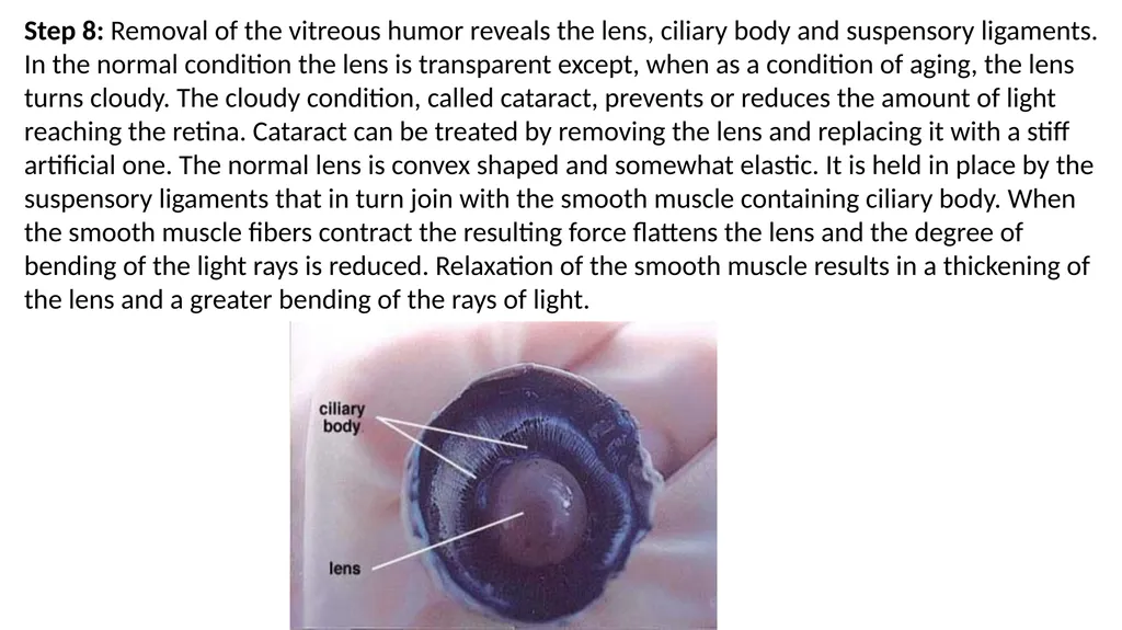 Eye Dissection Instructions Coach Blakley Step 1: - slide 8 of 11