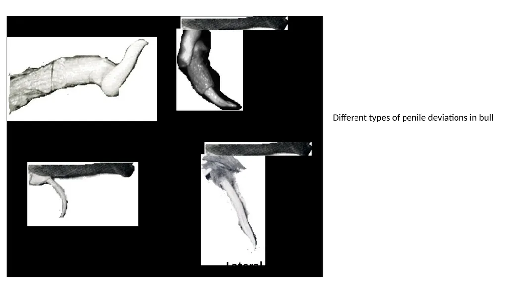 Impotentia Cocundi and Impotentia Generendi, - slide 21 of 24