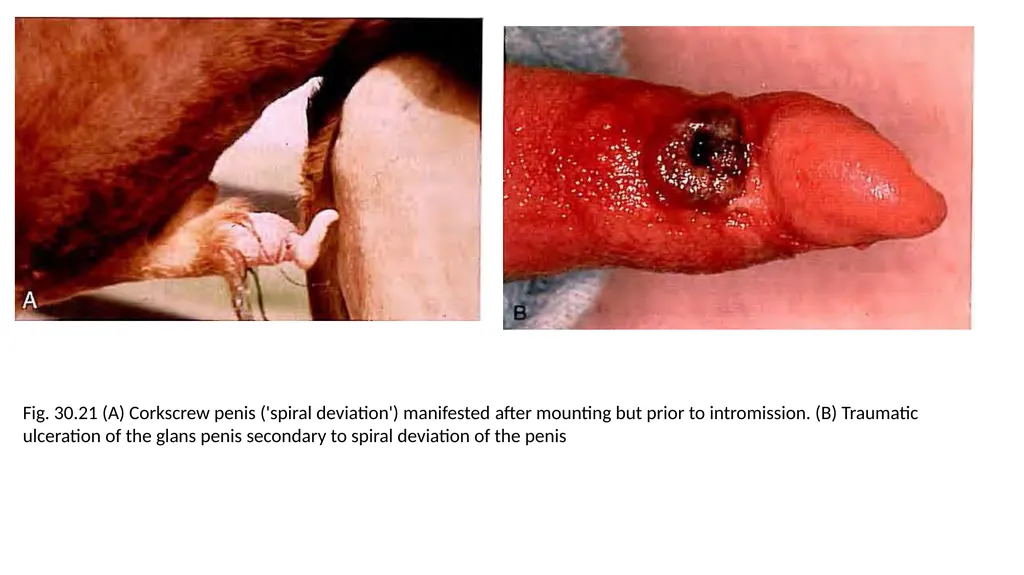 Impotentia Cocundi and Impotentia Generendi, - slide 19 of 24