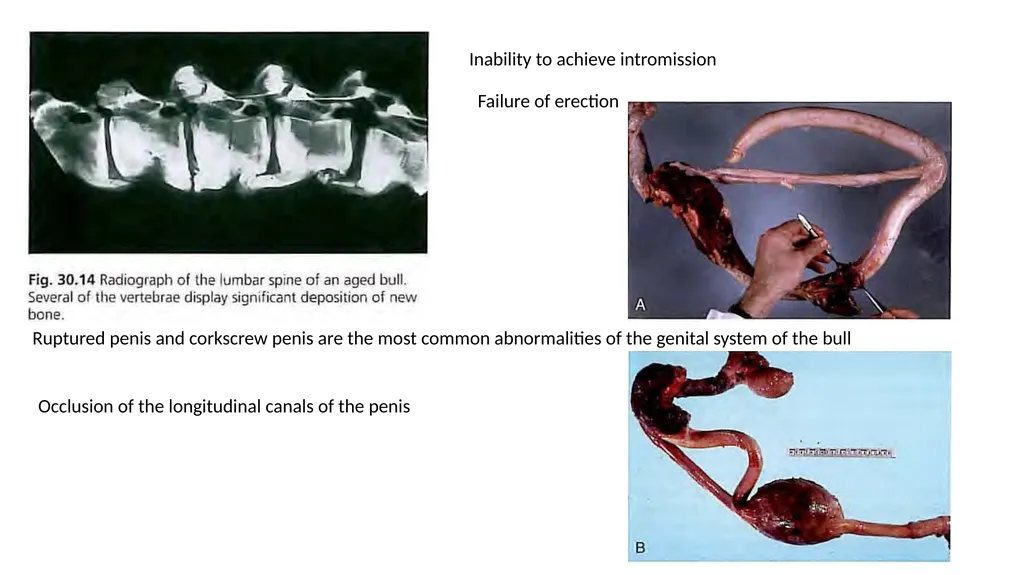 Impotentia Cocundi and Impotentia Generendi, - slide 14 of 24