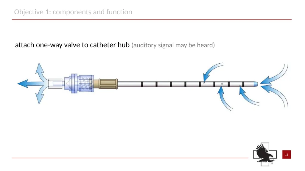 S P E A R™ decompression needle system Simplified - slide 11 of 36