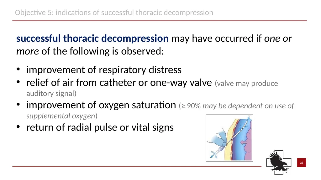 S P E A R™ decompression needle system Simplified - slide 31 of 36