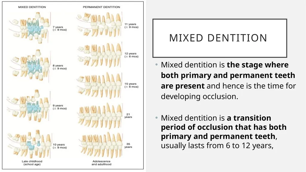 The Dentitions Dr. Pinar Khalis BDS, MSc in - slide 8 of 12