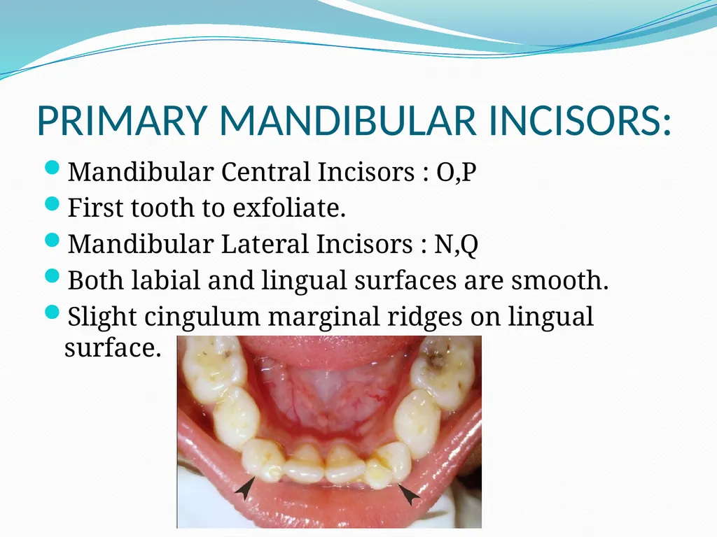 PRIMARY TEETH OBJECTIVES : 1) Identify name , - slide 16 of 22