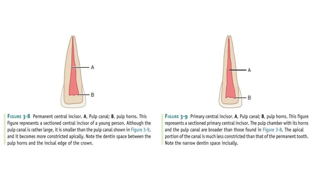 Lecture#3: Primary Dentition Dr Vinothkumar.S - slide 10 of 13