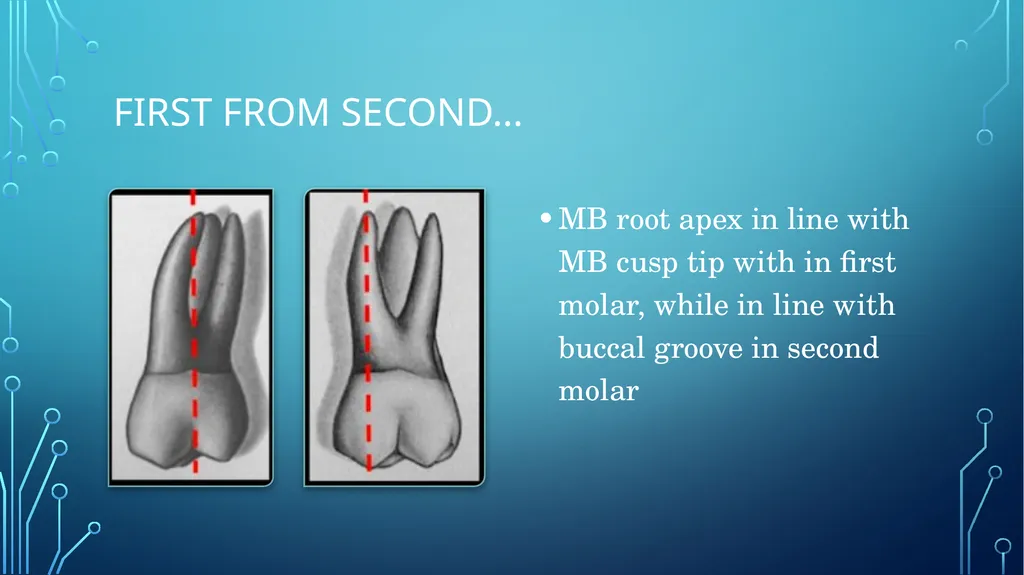 The permanent maxillary molars Dr. pinar khalis - slide 42 of 50