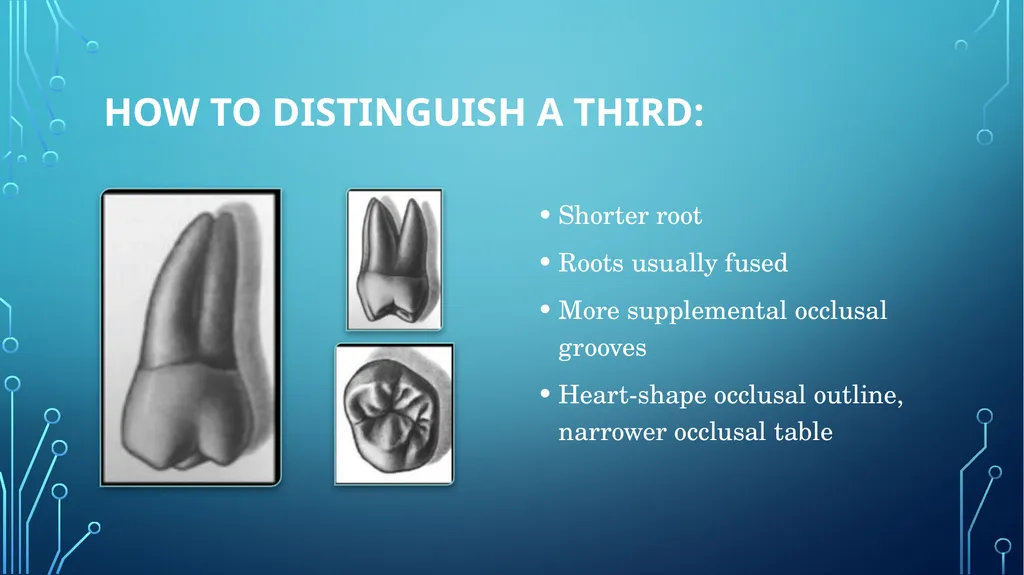 The permanent maxillary molars Dr. pinar khalis - slide 47 of 50