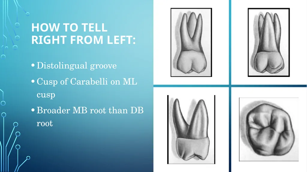 The permanent maxillary molars Dr. pinar khalis - slide 27 of 50