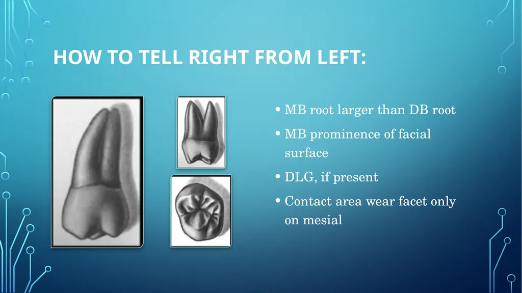 The permanent maxillary molars Dr. pinar khalis - slide 48 of 50