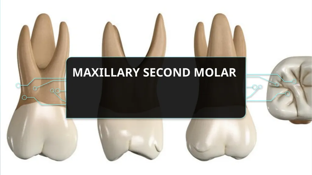 The permanent maxillary molars Dr. pinar khalis - slide 34 of 50