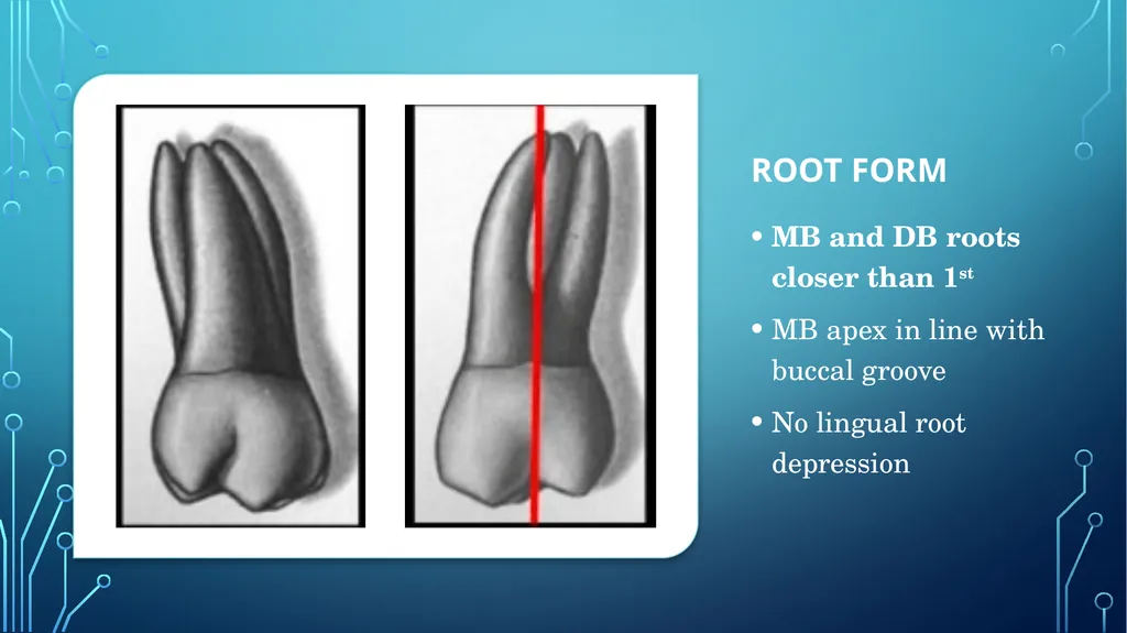 The permanent maxillary molars Dr. pinar khalis - slide 40 of 50