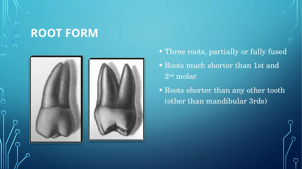The permanent maxillary molars Dr. pinar khalis - slide 46 of 50