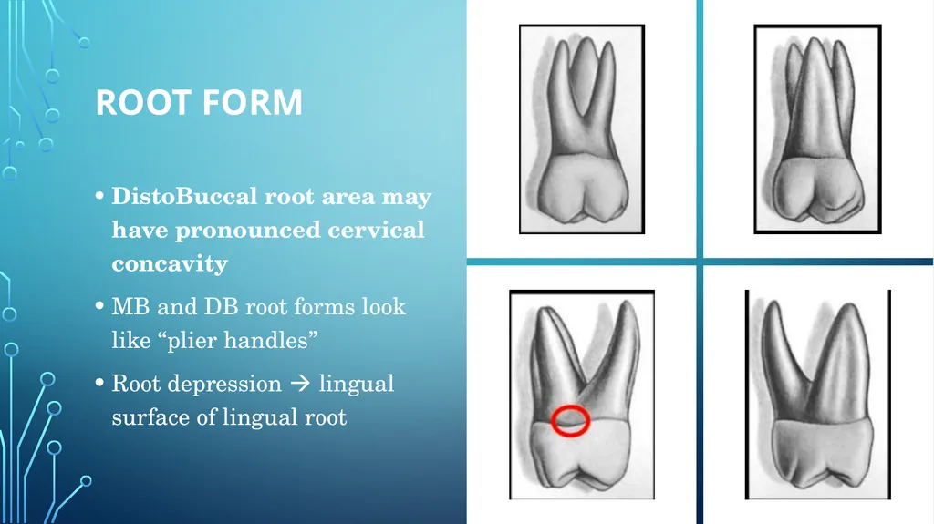 The permanent maxillary molars Dr. pinar khalis - slide 26 of 50