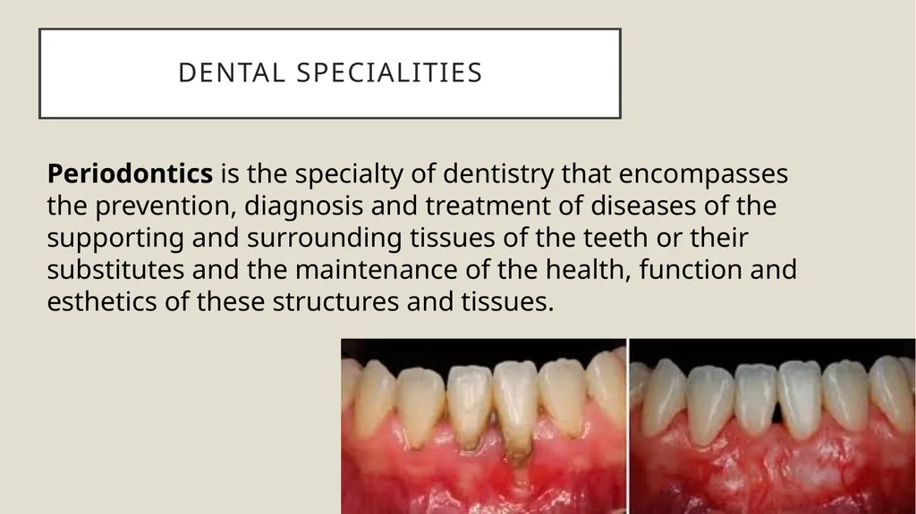 Dental terminology Dr Dina Taimeh Dental - slide 13 of 21