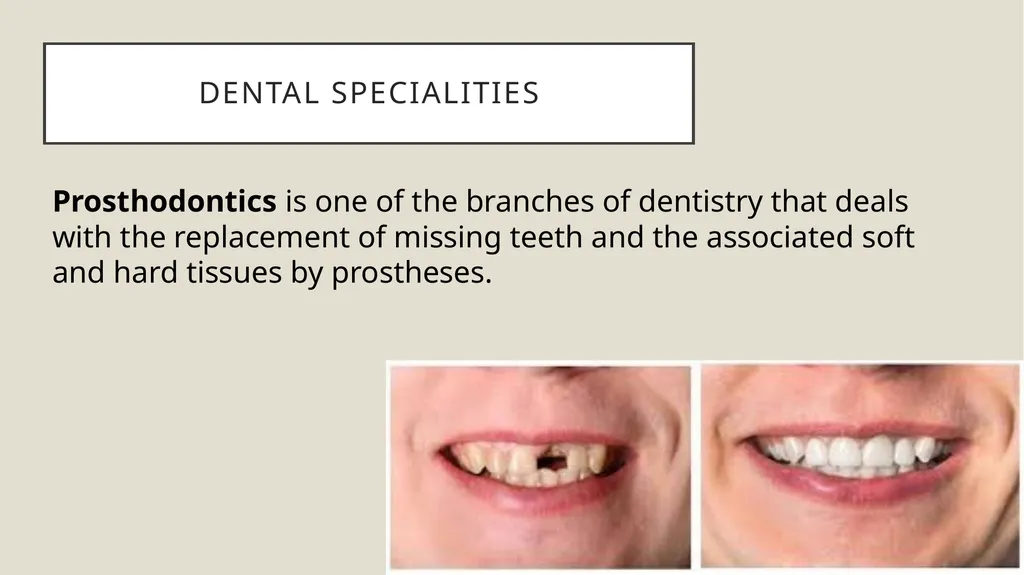 Dental terminology Dr Dina Taimeh Dental - slide 14 of 21