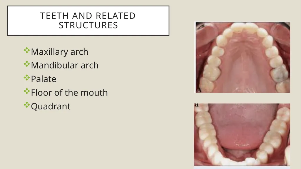 Dental terminology Dr Dina Taimeh Dental - slide 4 of 21