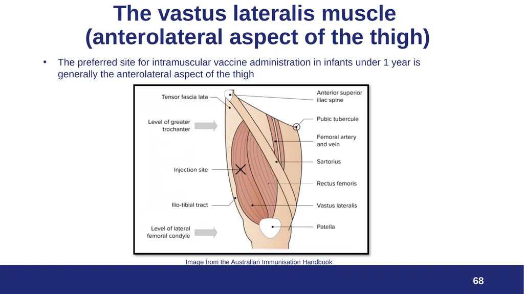 VPDP update: Respiratory Planning and Delivery - slide 68 of 79