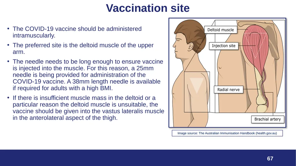 VPDP update: Respiratory Planning and Delivery - slide 67 of 79